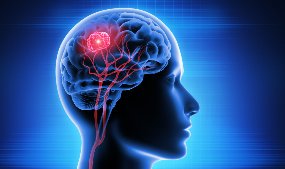 Brain Tumor Classification